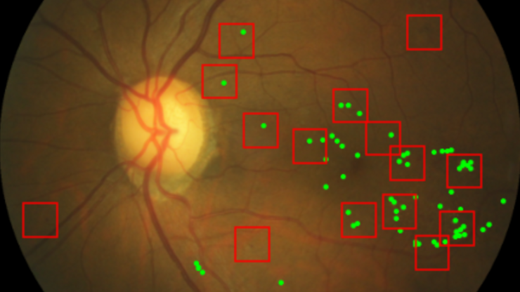 Research Group "Machine Learning for Safe Medical Diagnostics", Hertie AI