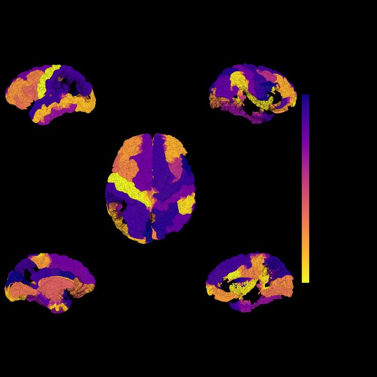 AI for Brain Simulation in Psychiatry